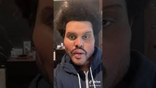 The Weeknd’s Plastic Surgery Before and After! (MUST WATCH) | tiktok edition ‼️ read description