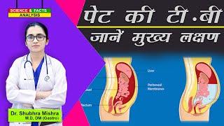 पेट की टी बी जानें मुख्य लक्षण  || Abdomen Tuberculosis