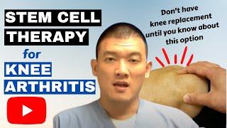 Stem cell therapy for knee arthritis | Florida Podiatrist #swfl #stemcelltreatment