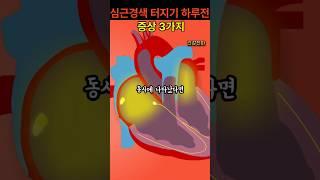 심근경색 터지기 하루 전 3가지 증상