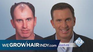 Visit WeGrowHairIndy.com