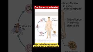 Onchocerca volvulus | Life cycle of organisms and pathogenesis of onchocerciasis