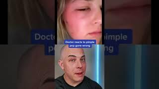 Doctor reacts to the risks of pimple popping! #pimple #pimplepopper #dermreacts