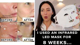 I used the CurrentBody LED Mask for 8 weeks & this happened.