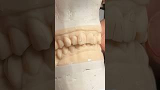 Performing a Diagnostic Wax-Up @EnvisiontecMain #envisiontec #dental #teeth #smile #lsk121shorts