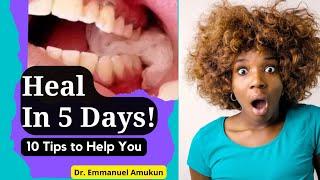 What to do after tooth extraction(Tooth pulled out) | Important instructions for speedy recovery!
