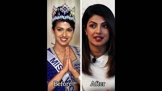 Bollywood actress before and after plastic surgery #short