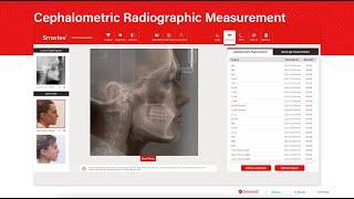 Smartee CEPH Measurement