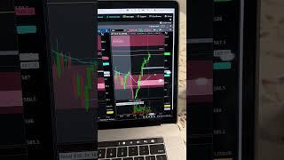 Don’t force a trade ‍️ #daytrader #daytrading #optionstrading