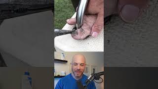 Derm reacts to HORRENDOUS toenail removal! #dermreacts #doctorreacts #toenailremoval