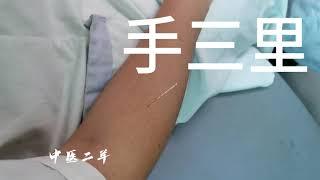 感冒后鼻塞流涕，中医二羊亲试，用两个穴位，下完针就改善