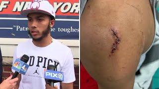 Pedro Hernandez says he was the victim after slashing, robbery arrest