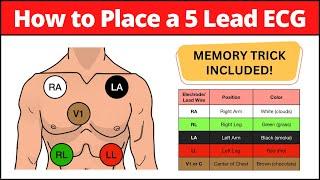 How to Place a 5 Lead ECG: MNEMONIC [Electrode Placement Made Easy] #nursing