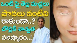 ఒంటి పై తెల్ల మచ్చలు రాకుండా చేసే రెమెడీ | Bolli Machalu | Vitiligo | Dr Manthena Satyanarayana Raju