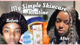 My Affordable Skincare Routine For Acne & Scars | South African YouTuber