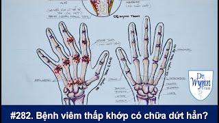 # 282. Viêm thấp khớp có thể chữa dứt hẳn? Cập nhật chẩn đoán và chữa trị