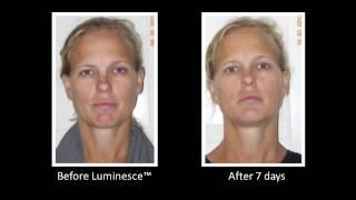 Jeunesse Global LUMINESCE Cellular Rejuvenation Serum Amazing Before & After Photos