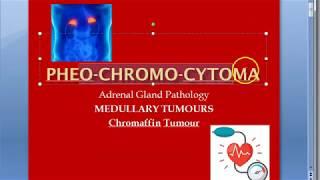 Pathology 807 b PheoChromoCytoma Clinical feature Gross Microscopy Hypertension zellballen pattern