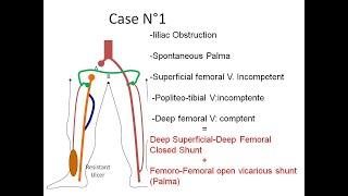 New hemodynamic concepts Franceschi 2020