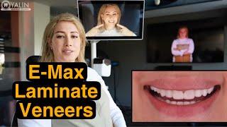 E- MAX LAMINATE VENEERS Smile Makeover | Dental Clinic in Turkey Antalya #E-MAX #veneersturkey