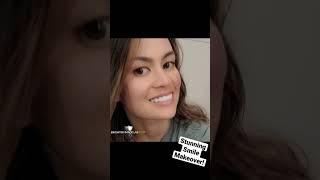 Beautiful Smile Makeover! Dental Veneers by Brighter Image Lab