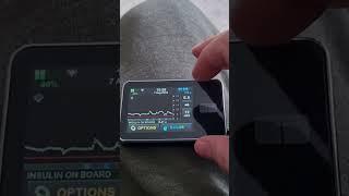Control IQ - Hybrid Closed Loop Over 24 Hours | T:Slim X2 Insulin Pump