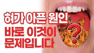 입안이 불덩이,  혀가 아픈 원인, 구강작열감증후군 바로 이것이 문제입니다｜노기환 원장