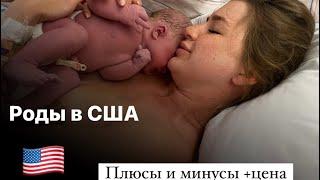 Сколько стоят роды в США ?￼