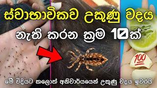 10 Ways To Get Rid Of Lice Naturally | ස්වාභාවිකව උකුණු වදය නැති කරන ක්‍රම 10ක්