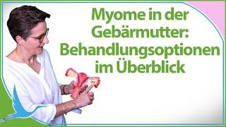 Myome in der Gebärmutter: Die Behandlungsoptionen im Überblick  (Heidi Gößlinghoff)