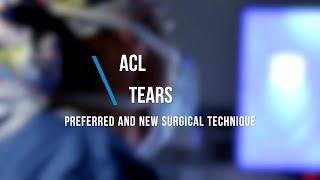 ACL Tears - Preferred and New Surgical Technique