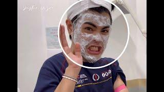 Acne Scars Treatment | Philippines | Adraneda Dermatology Clinic | Justin Dizon