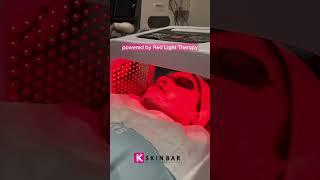Queens  Facial treatment #glassskin #chemicalpeel #facial #hydrafacial