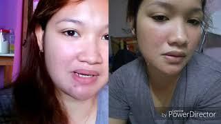 PORCELANA - EFFECTIVE WHITENING AND TREATMENT FOR ACNE