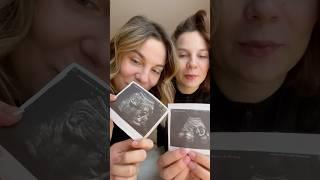 Двойное пополнение от двойняшек  #двойняшки #двойня #беременность #подружки