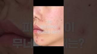 피부 장벽 케어가 진짜 중요합니다 (ft.약국템)