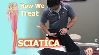 How We Treat Sciatica | Physical Therapy