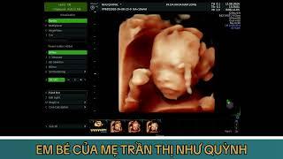 EM BÉ CỦA MẸ TRẦN THỊ NHƯ QUỲNH - HỢP THỊNH, TAM DƯƠNG, VĨNH PHÚC - EM BÉ ĐƯỢC 19 TUẦN 04 NGÀY