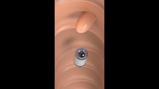 Capsule Endoscopy #science #shorts #medicine