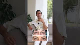 Dr. Imran — Консультация по окулопластике #oftalmolog  #doctor #gözhəkimi