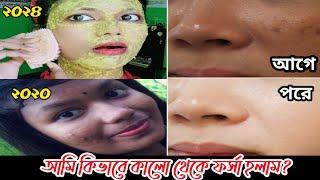 এটা লাগিয়ে কালো থেকে ফর্সা হলাম | My skin whitening home remedies | skin brightening facial