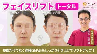 【切開リフトで若返り！】フェイスリフト(トータル)の施術と症例 ／MIYAフェイスクリニック