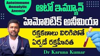 What is AutoImmune Hemolytic Anemia | Treatment and Cure | Dr Karuna Kumar | Hematologist