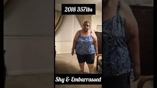 Before and After Motivation on my Weight Loss Journey to Lose 180lbs Naturally with Diet & Exercise