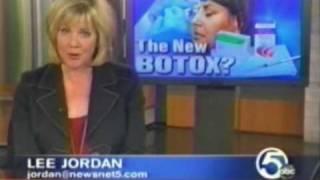 The New Botox?  Dr. Goldman is the first to have it in Northeast Ohio.