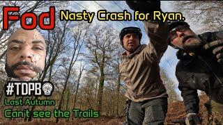 Crash Ends with 31 Stitches
