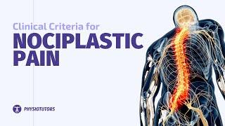 Clinical Criteria for Nociplastic Pain | Jo Nijs from Pain in motion