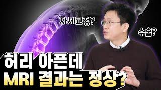 허리 통증의 원인과 척추 건강을 지키는 비법 알려줄게