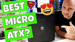 The Best MATX Case Ever Thermaltake Core V21