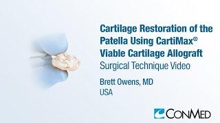 Dr. Brett Owens - Cartilage Restoration of the Patella Using CartiMax® - CONMED Surgical Technique